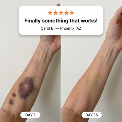 💥100K+ SOLD💕 Bruise Repair & Skin-Strengthening Cream